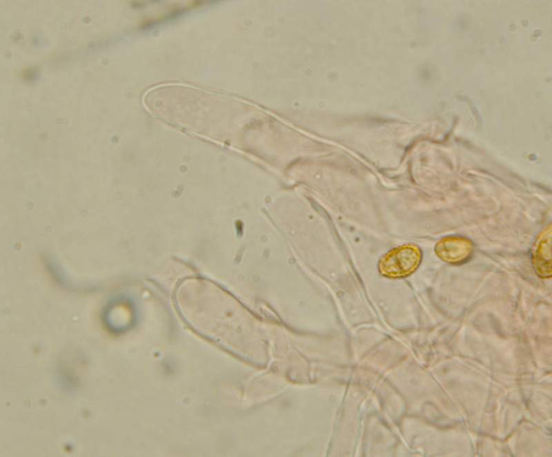 Fungo e il suo micelio.......